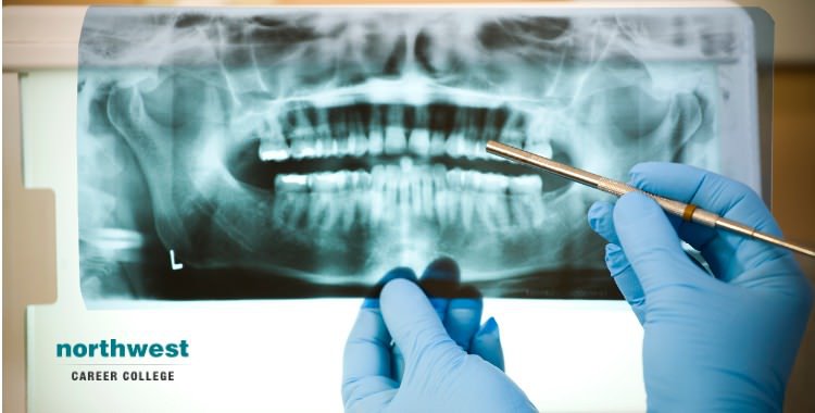 dental x-ray