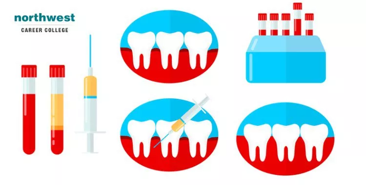 platelet rich plasma in dentistry