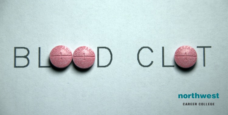 Blood Clot