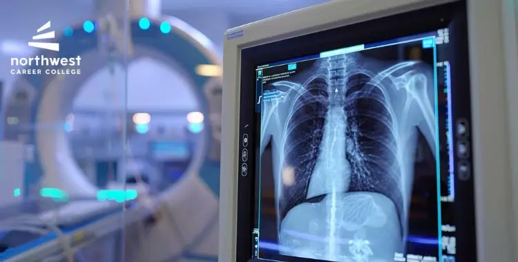 X-ray image of lungs displayed on a monitor in a medical setting with a CT scanner in the background.